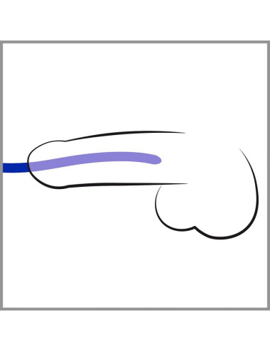 Silicone Dilator Set