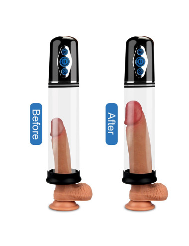 Maximizer Worx Elite Rechargeable Pump